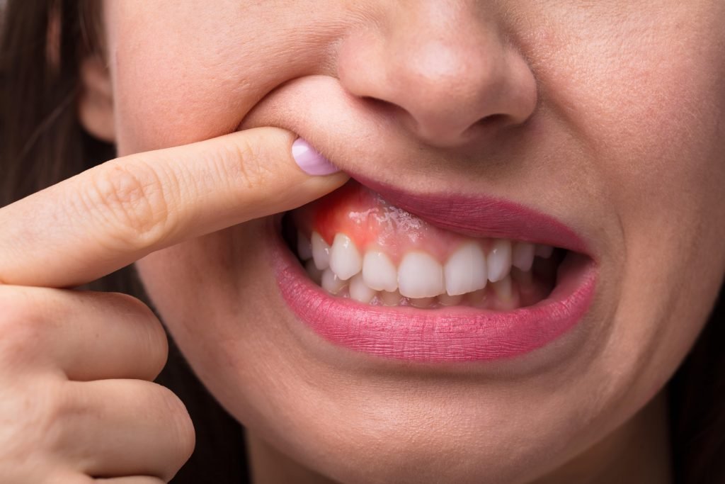 Periodontia na Núcleo Odontologia em Juiz de Fora