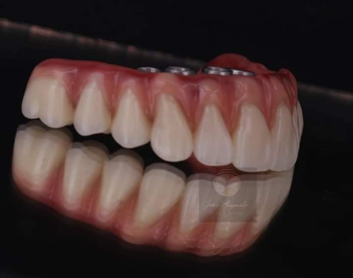 Prótese Dentária Santana